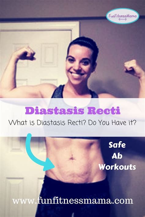 Diastasis Recti What Is It And Do You Have It — Funfitnessmama