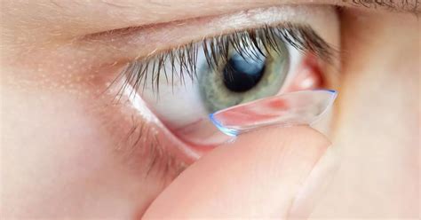 Contact Lens Wearers Warned Of Outbreak Of Infection Which Can Cause Blindness Birmingham Live