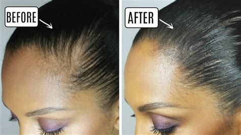 How To Cover Bald Spot With Makeup Mugeek Vidalondon