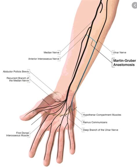 Ain Compressive Neuropathy Hand Orthobullets