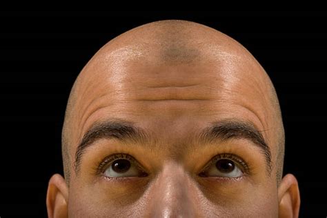 49600 Bald Head Fotografías De Stock Fotos E Imágenes Libres De