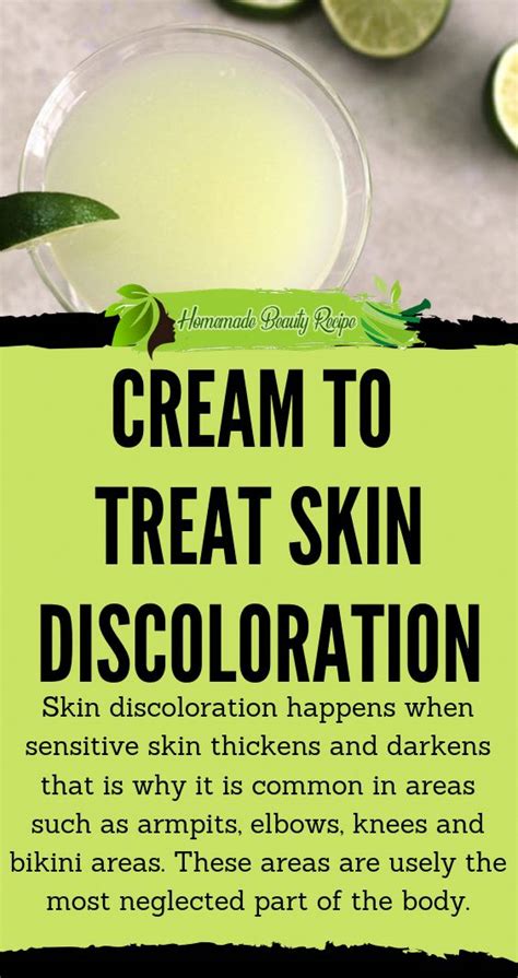 Cream To Treat Skin Discoloration In 2020 Skin Discoloration Skin