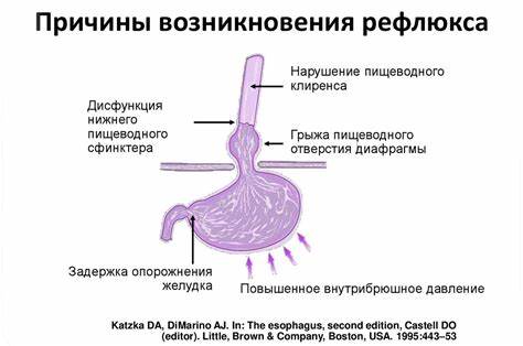 Эзофагит лечение диета симптомы Рефлюкс Эзофагит Лечение Диета У Взрослых — Похудение Диета Правильное Рефлюкс Эзофагит Лечение Диета У Взрослых — Похудение Диета Правильное Эзофагит лечение диета симптомы