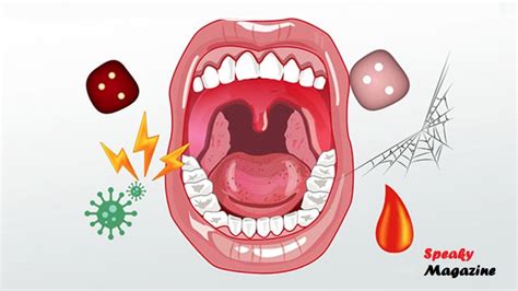 The 20 Most Common Mouth Diseases Speaky Magazine