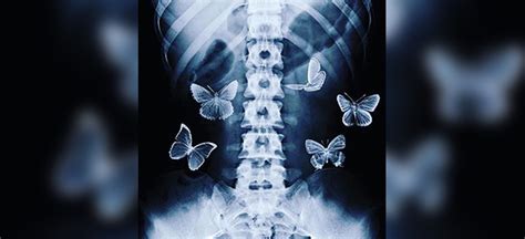 are butterflies in the stomach a sign of love