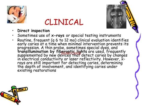 Dental Caries Ppt