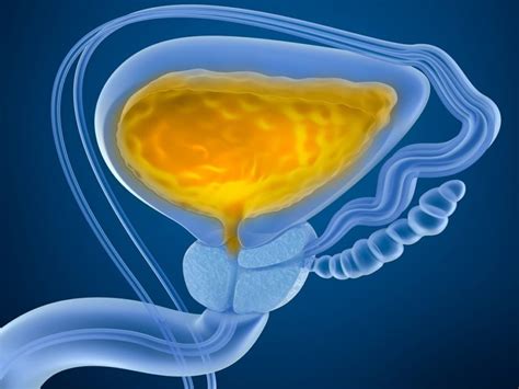 Urine Cytology May Not Improve Hematuria Evaluation For Bladder Cancer