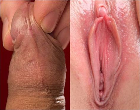 Circumcised Female Clitoris