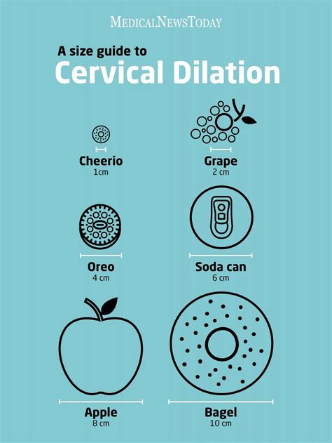 Cervix Dilation Chart The Stages Of Labor Explained In Pictures My
