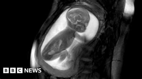 Detailed Images Of Baby Heart Inside The Womb Bbc News
