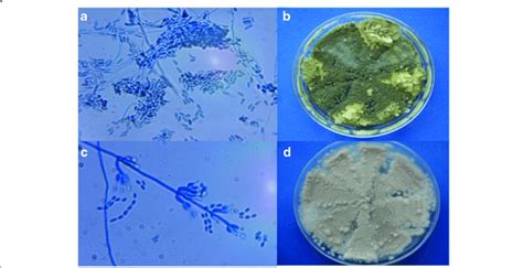 Microscopic And Macroscopic Features After Fungal Growth Of Samples