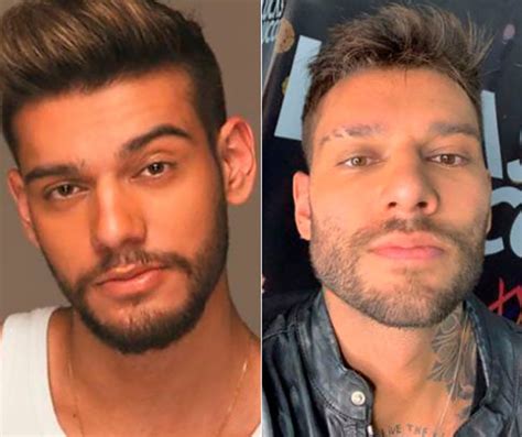 23,573 likes · 6 talking about this. Antes e Depois de famosos que fizeram harmonização facial ...