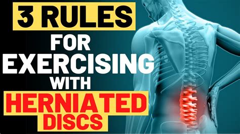 Exercising With Herniated Disc 3 Must Follow Rules For Exercising