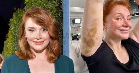 Bryce Dallas Howard Shows Off Bruises While Filming For Jurassic World