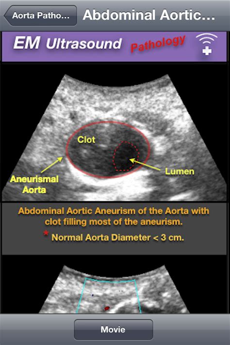 You can also access the past fake gps by hola. EM Ultrasound App for iPhone is a comprehensive reference ...