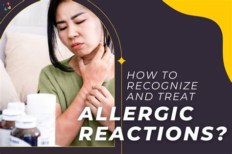 How To Recognize And Treat Allergic Reactions Important Points The