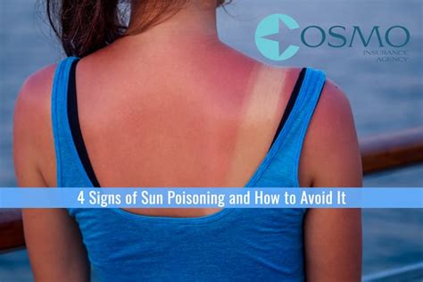 4 Signs Of Sun Poisoning And How To Avoid It Best Nj Insurance