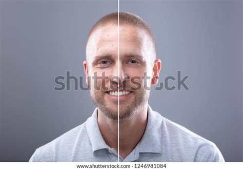 Portrait Smiling Mans Face Before After Stock Photo 1246981084