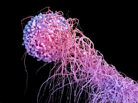 A Closer Look At The Top 5 Deadliest Cancers