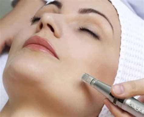 Microneedling Course North West Training Vocational College