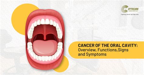 Oral Cancer Overview Functions Signs And Symptoms Cytecare Hospitals