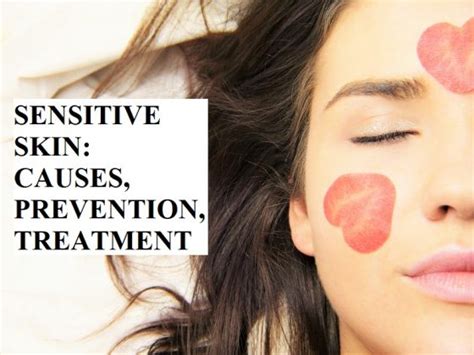Most Sensitive Skin Problems Causes Prevention And Treatment