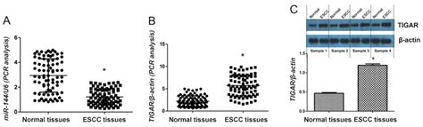 microrna‑144 inhibits cell proliferation and invasion by directly targeting tigar in esophageal