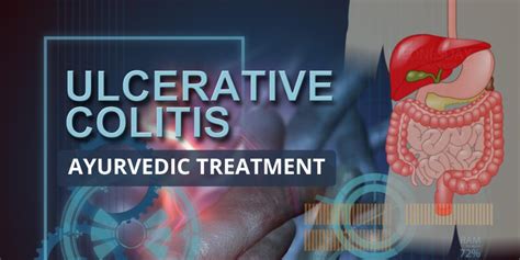 Ayurvedic Treatment For Ulcerative Colitis