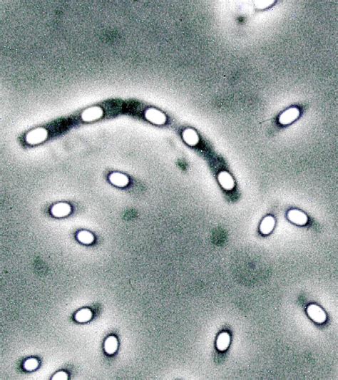 Bacillus Cereus Junglekeyfr Image