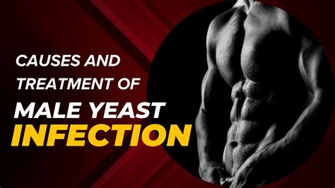 Male Yeast Infections Youtube