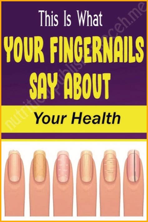 This Is What Your Fingernails Say About Your Health In 2020 Health