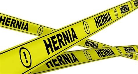 Hernia When Do You Need Surgery Hartford Healthcare Ct