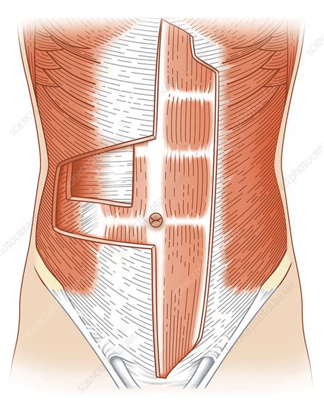 Abdominal Muscle Layers Artwork Stock Image C010 7080 Science