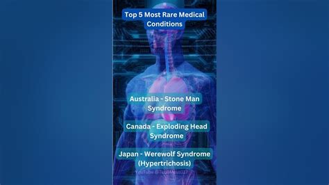 Top 5 Most Rarest Medical Conditions Youtube