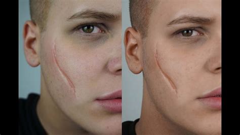 Pin By Jessica Cook On Facial Scars Face Scars Facial Scars Scar Makeup
