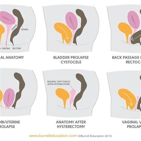 Conditions We Treat Physiotherapy Ltd Physiotherapy Sunderland