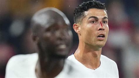 In Pictures Cristiano Ronaldo Suffers A Bleeding Nose During Portugal