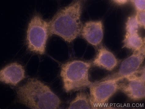 Beta 2 Microglobulin Antibody Cl555 13511 Proteintech