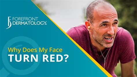 How To Stop Face Redness When Exercising Exercise Poster