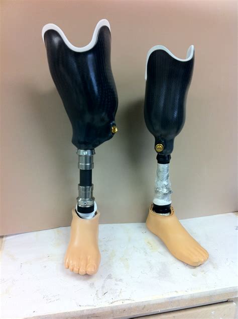 Right And Left Below Knee Transtibial Prosthesis Created By Dann