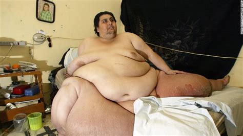 El hombre más obeso del mundo deja su cama por primera vez en años CNN
