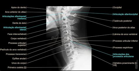 Coluna Radiografia Padrão Anatomia Normal E Anatomy