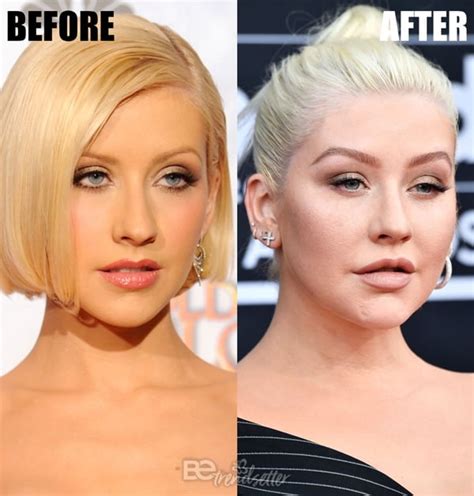 Christina Aguilera Plastic Surgery Secrets Boob Job Lip Fillers