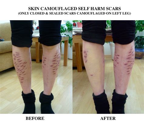 How To Cover Up Self Harm Scars On Legs With Makeup Makeup Vidalondon