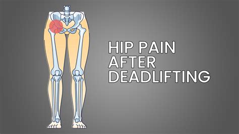 Hip Pain After Deadlift 4 Potential Reasons Explained Inspire Us