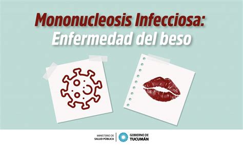 Enfermedad Del Beso Ministerio De Salud Pública De Tucumán