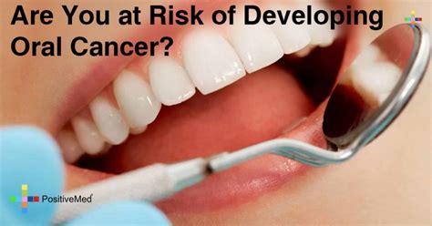 Are You At Risk Of Developing Oral Cancer Positivemed