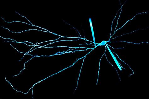 Electrical Properties Of Dendrites Help Explain Our Brains Unique