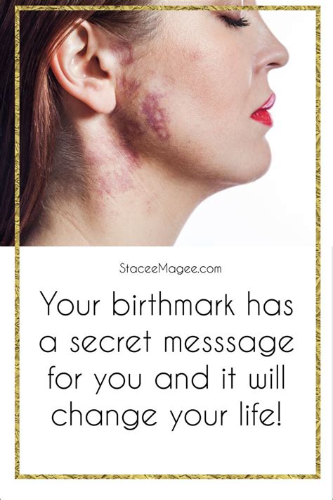 Learn The Meaning Of Your Birthmarks Birthmark Body Positivity
