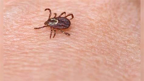 Meat Allergy After Tick Bite May Explain Severe Allergic Reactions
